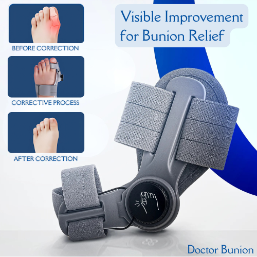 Doctor Bunion Corrector